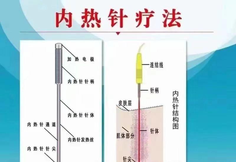 理论基础