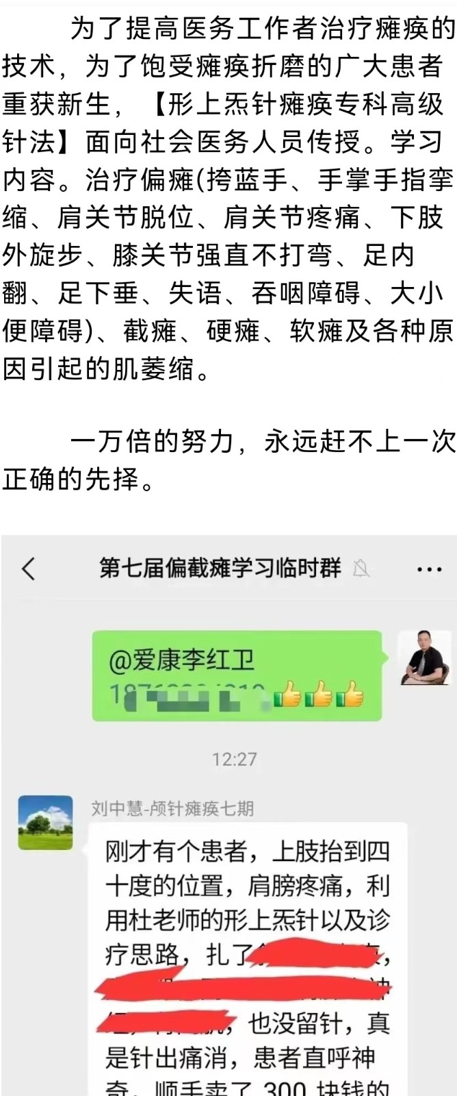 针灸 形上炁针技术治疗中风偏瘫专修班 杜永欣老师