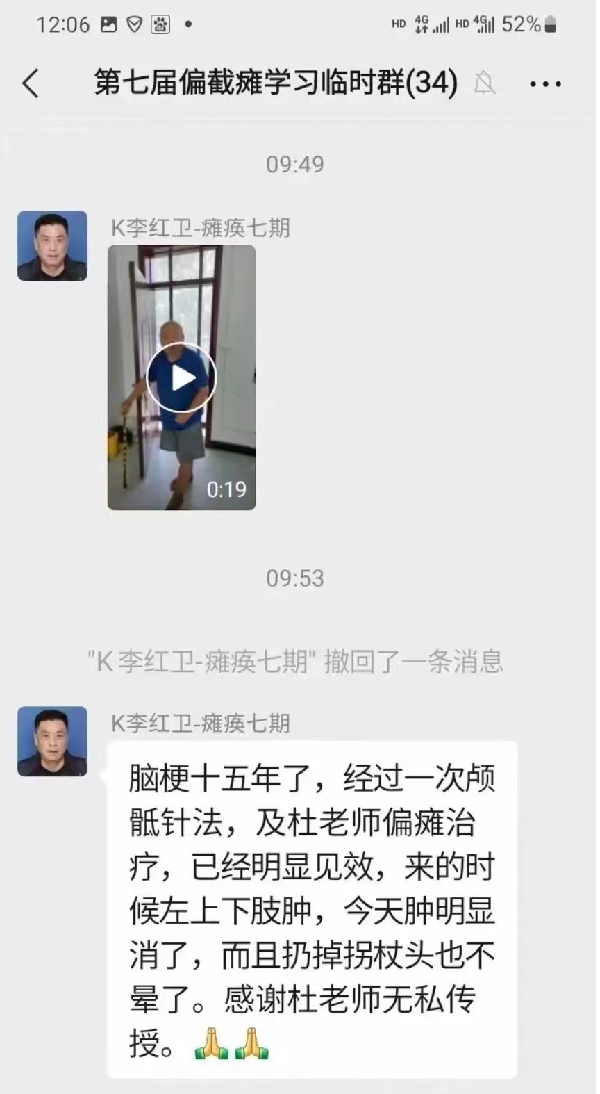 针灸 形上炁针技术治疗中风偏瘫专修班 杜永欣老师