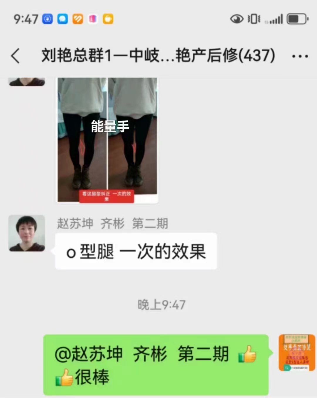 刘艳《能量手产后修复》调理O型腿案例分享