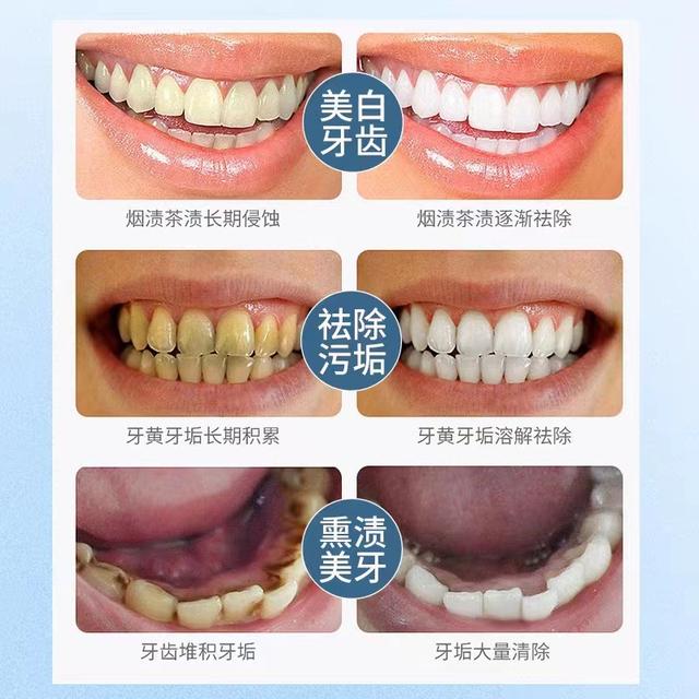 什么是原牙色素提取