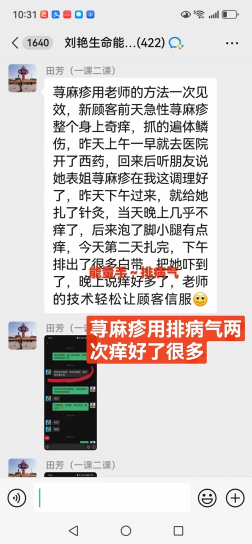 刘艳能量手学员调理荨麻疹反馈