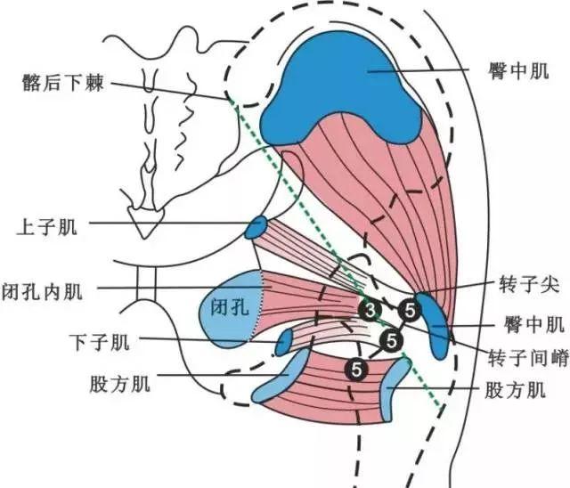 针刀医学【定点标志】  