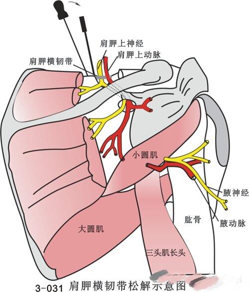 24年昆明贵阳针刀临床解剖班