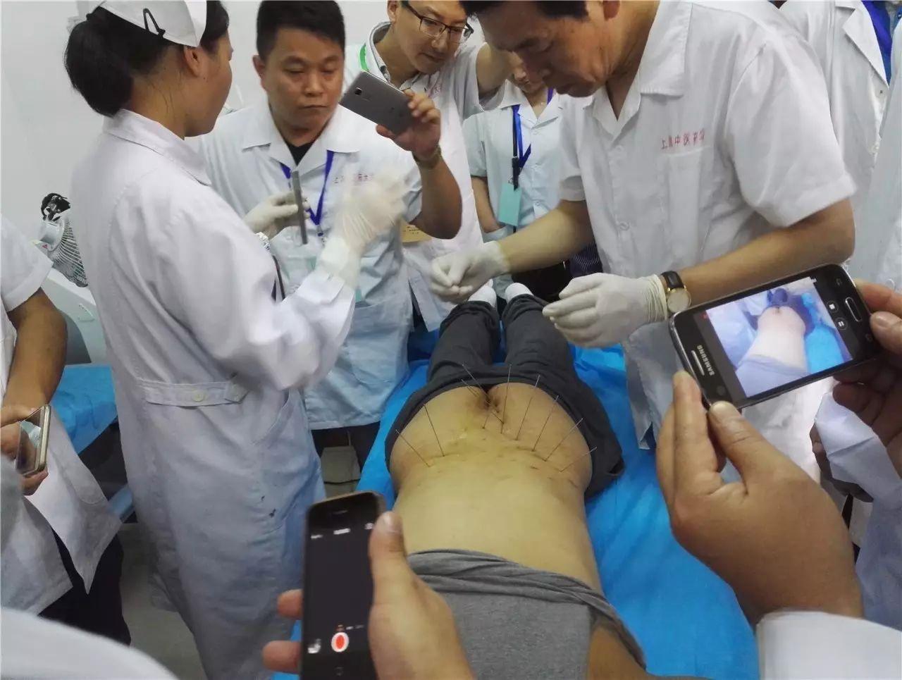 5月1日上海密集型银质针疗法讲习班