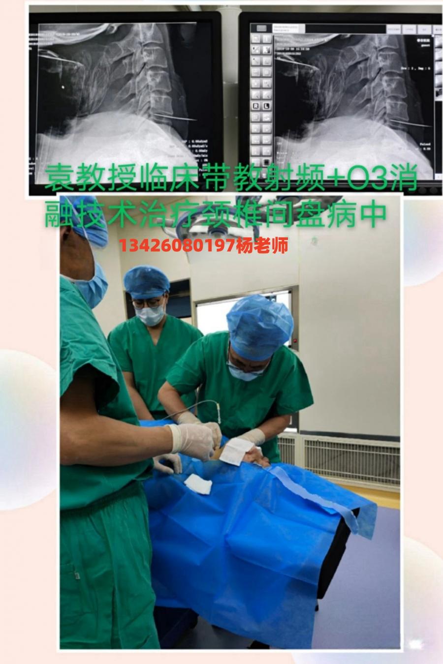 袁明省教授 带教动脉注射专业治疗脑血管病