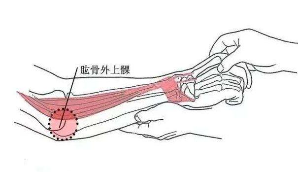 针刀基础软组织损伤的病理变化过程