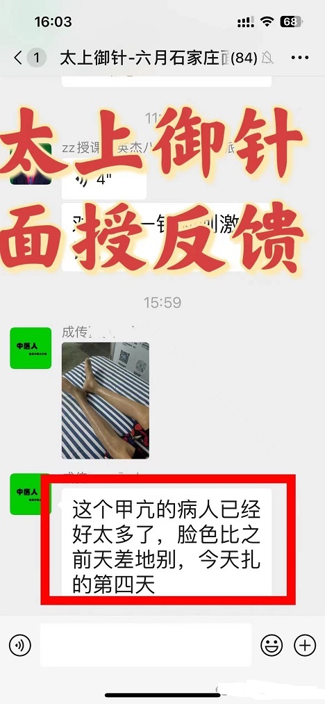 王英杰太上御针学员反馈--治疗甲亢