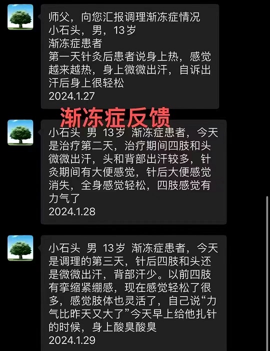 妙珍正阳归元针学员反馈--渐冻症