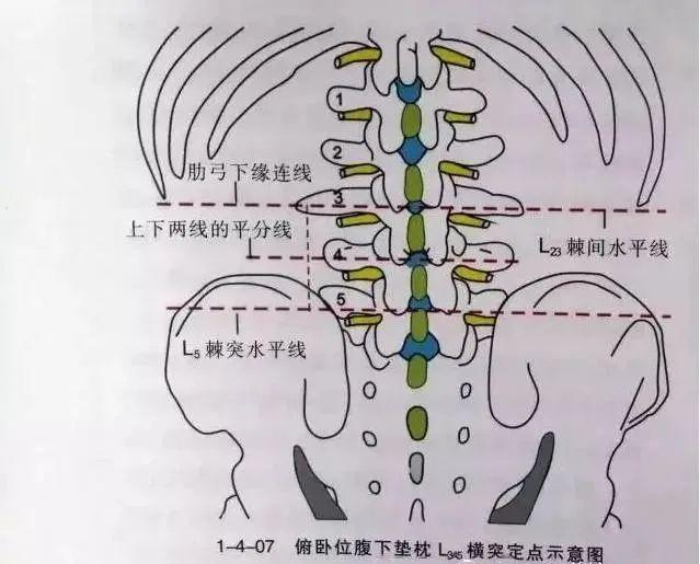 內(nèi)口、外口針刀臨床松解經(jīng)驗(yàn)
