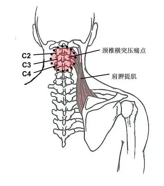 甘肃杭州贵阳等小针刀治疗软组织疼痛班