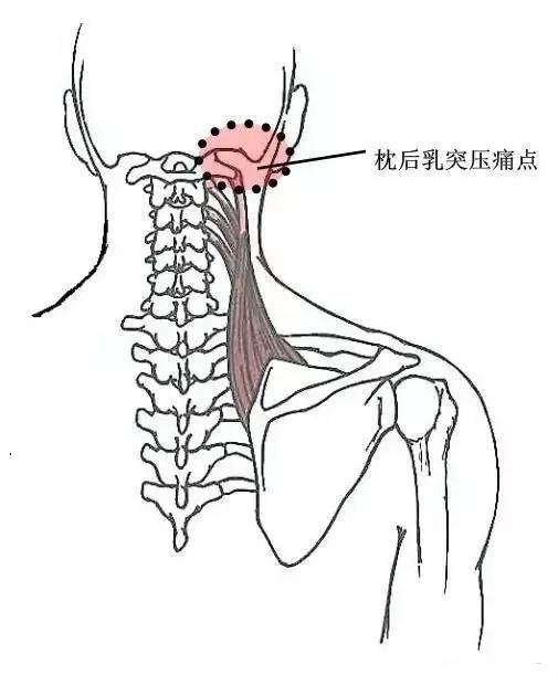 甘肃杭州贵阳等小针刀治疗软组织疼痛班