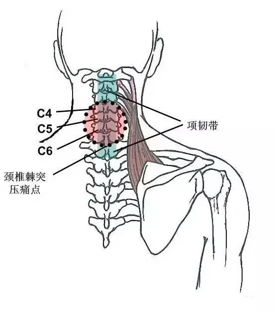 甘肃杭州贵阳等小针刀治疗软组织疼痛班