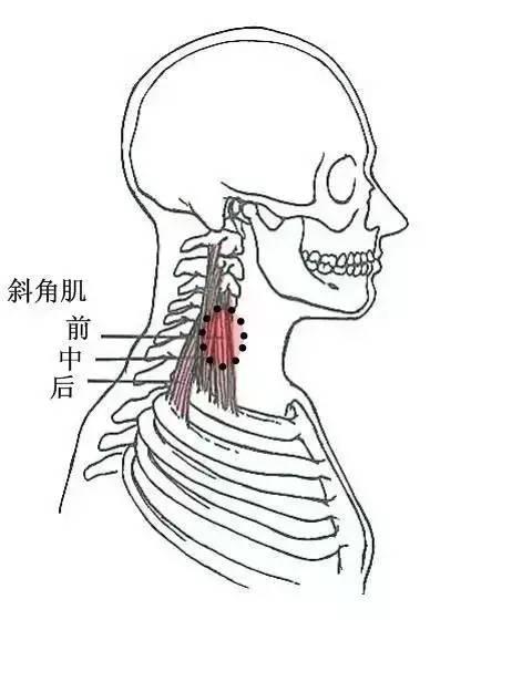 甘肃杭州贵阳等小针刀治疗软组织疼痛班