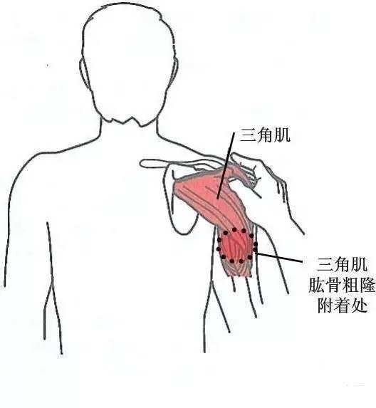 甘肃杭州贵阳等小针刀治疗软组织疼痛班