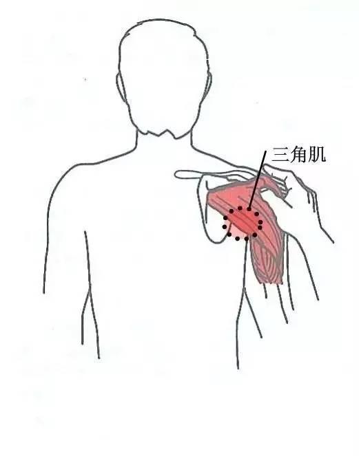 甘肃杭州贵阳等小针刀治疗软组织疼痛班