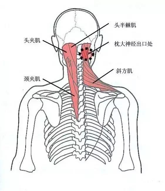 甘肃杭州贵阳等小针刀治疗软组织疼痛班