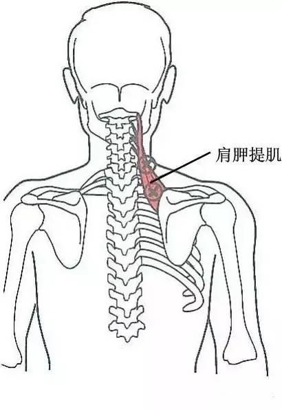 甘肃杭州贵阳等小针刀治疗软组织疼痛班