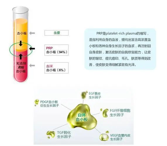 PRP技术骨病疼痛及美容临床应用研修班