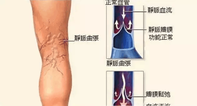 4月广州-痔疮、静脉曲张、男科培训班